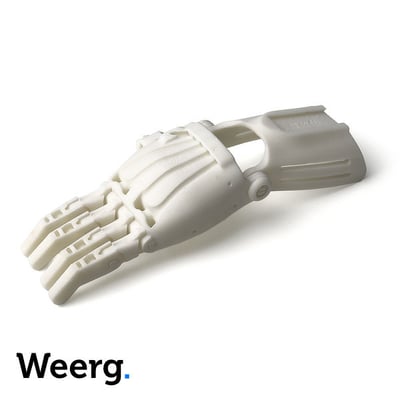 Prothèse médicale en abs imprimée en 3D par Weerg