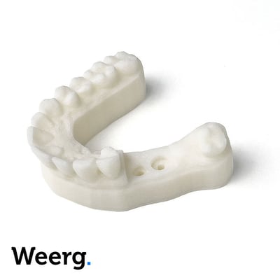 L'impression 3D dans le secteur dentaire